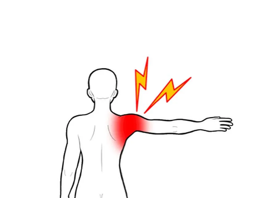 五十肩の症状には、原因が多種多様にあります。